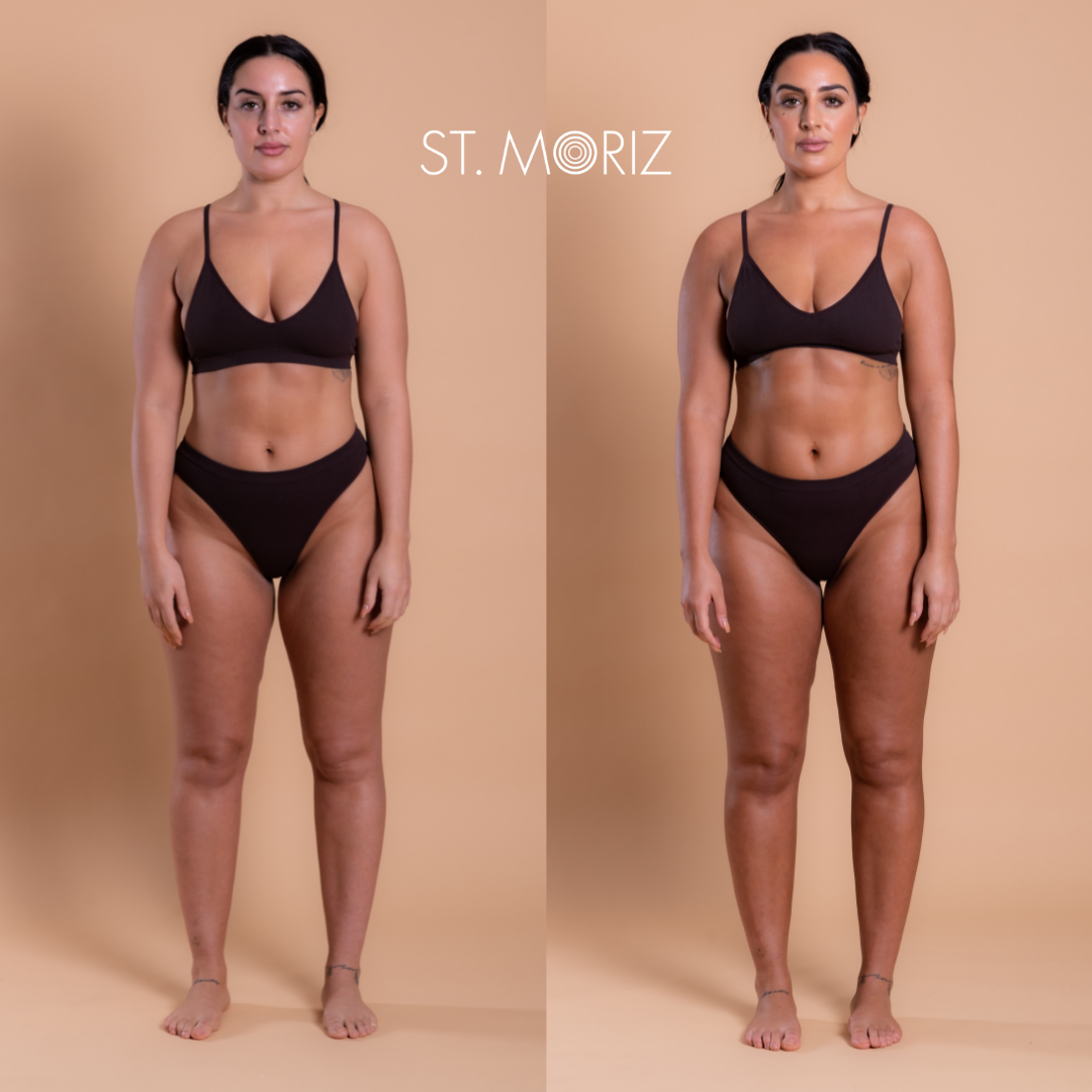 St. Moriz Professional Self-Tanning Mousse Dark
